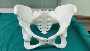 3D Printing Orthopedics